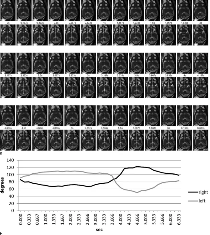 Figure 5. Measurements of bulb positions on sequential axial images. a Thirty-nine sequential frames of an axial dynamic SSFP sequence in a fetus at 27 + 1 GW (first, third, and fifth rows) and the same frames with measurements of bulb positions (second, f