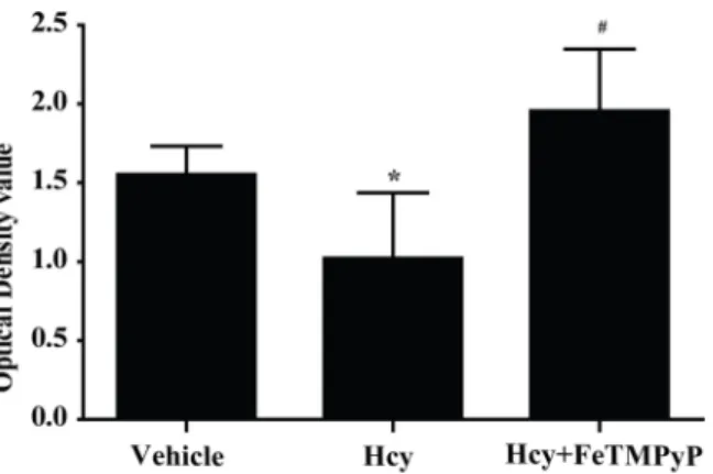 Fig 8. MTT assay of EPCs on the role of homocysteine. The survival rate of homocysteine group was significantly decreased, and improved significantly after pretreatment with FeTMPyP