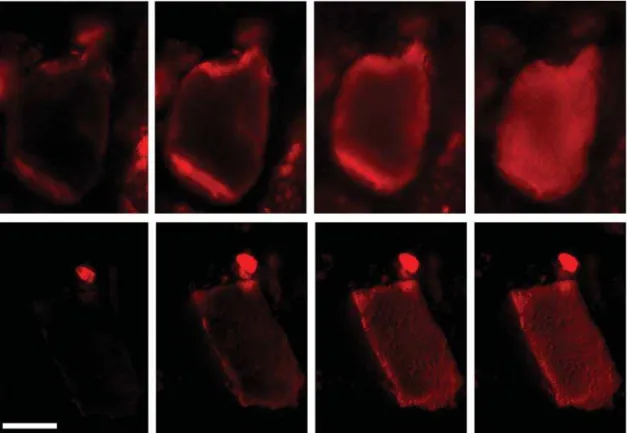 Figure 3. Penetration of fluorescently labeled Versazyme TM (represent- (represent-ed by r(represent-ed color) into a bone particle, after 10 minutes incubation