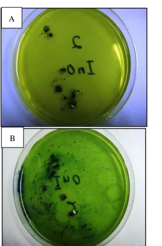 Figure 2. (A and B) Show the color changes after 24&amp; 48  hours with innovation R self-ligating brackets respectively