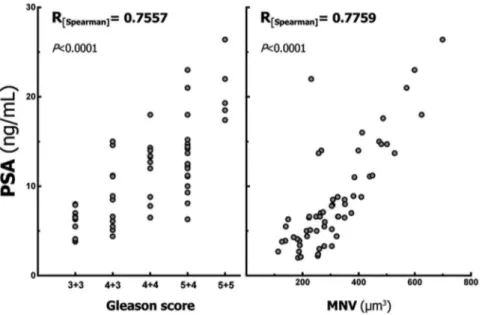 Figure 2. Correlations between the prostate specific antigen (PSA) value and both the Gleason score and mean nuclear volume (MNV)