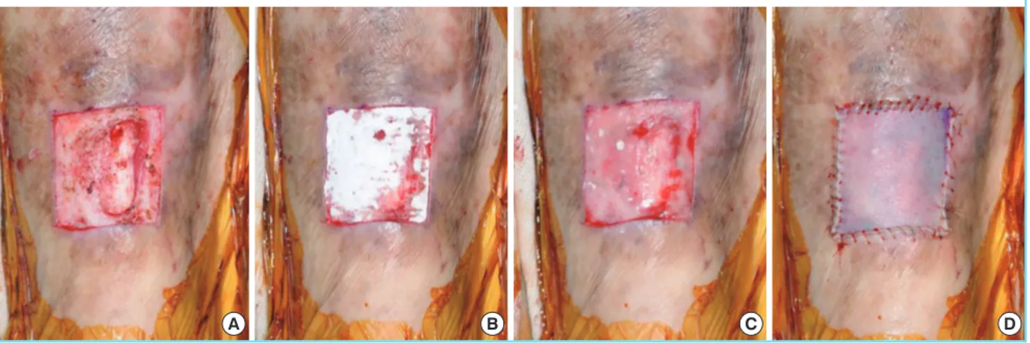 Fig. 1. Experimental group with Matriderm appliance