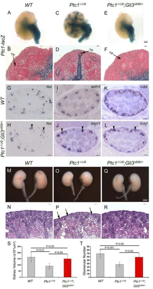 Figure 5. GLI3 repressor is required for ureteric tip cell-specific gene expression and function