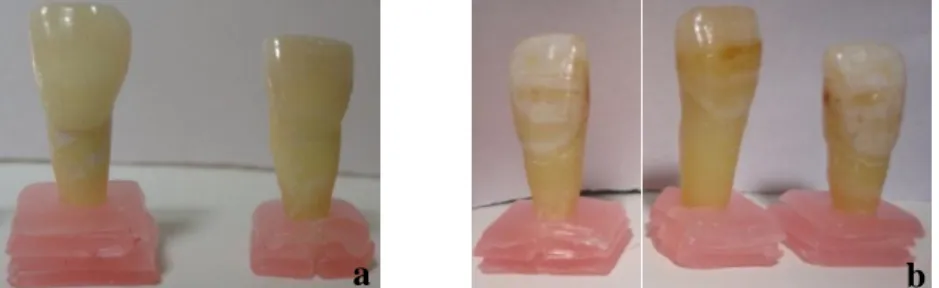Figura 1: a) Espécimes sem fluorose dentária; b) Espécimes com fluorose dentária. 