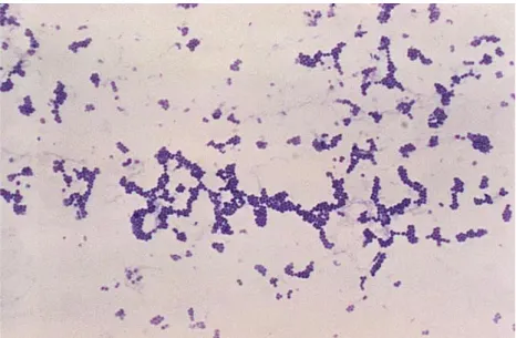 Figure  1:  Microscopic  observation  of  Staphylococcus  aureus.  The  results  of a  Gram  stain  applied  to  Staphylococcus  aureus  are  shown,  obtained  from  a  microscopic  view