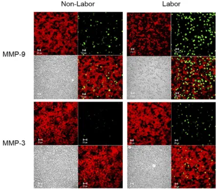 Fig 7. MMP-9 and MMP-3 are produced in large amounts during labor. Representative
