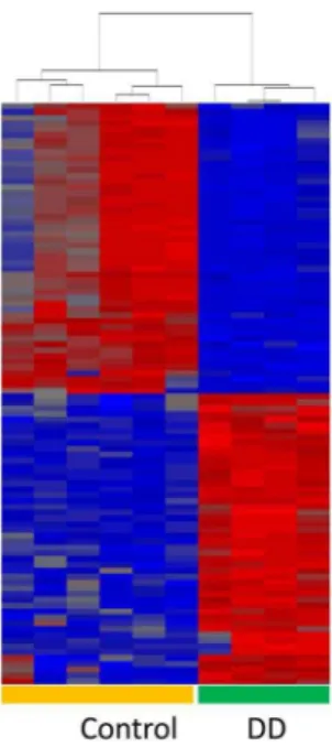 Figure 1. Dupuytren’s disease (DD) samples show many genes that are differentially expressed compared to control samples.