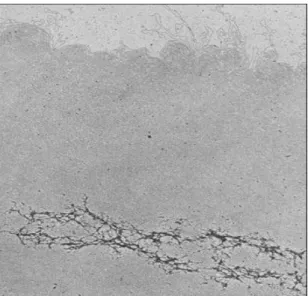 Figure 3 - After removing histone proteins, the  scaffold proteins are well visible at electronic  microscope, as the darker set of lines, attached to this  darker lines are the DNA loops (without histones),  the points of attachment between the DNA loops 