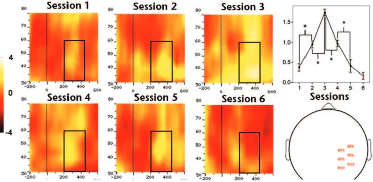 Figure 4. Effect of training over mean N2pc amplitude. A) Grand average ERPs contralateral-to-target and difference -waves (contra minus ipsilateral) obtained from sessions 1, 3 and 5 and from electrode: A) LO2 left occipital; B) Average topographic distri