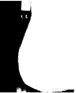 Fig. 4b The corresponding image cleaned  by the noise cleaning method 