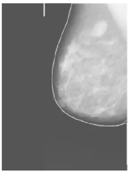 Fig. 2e Lines from first and second tracings  (grey and white respectively) were  superimposed on the adjusted mdb015 