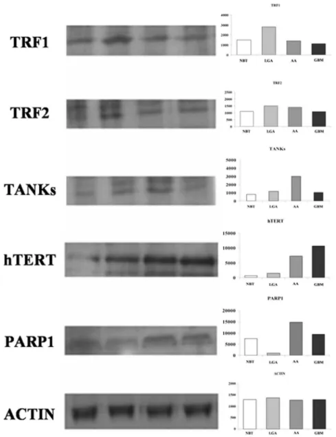 Figure 4. Western blot analysis of TRF1, TRF2, h-TERT, TANKs, and PARP-1. Left: representative autoradiogram; right: graphs with quantitative data
