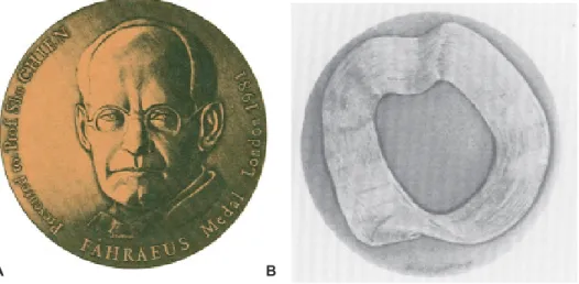 Fig. 3 – Primeira medalha Robin Fåhraeus, atribuída em 1986 a Shu Chien. (A- frente e B- verso)A                                                                       B