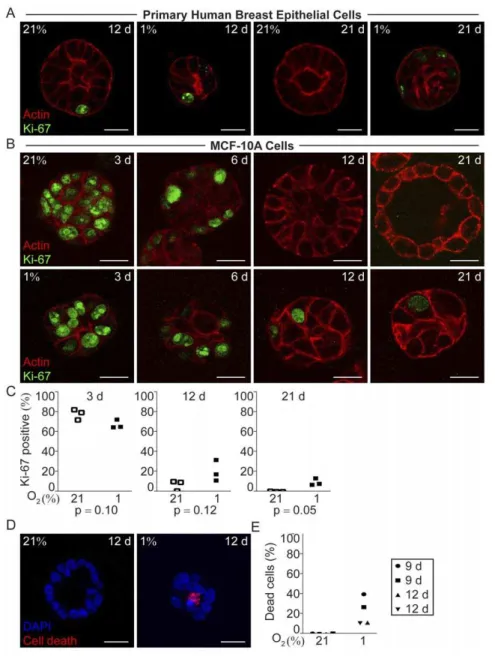 Figure 2. Proliferation and cell death in hypoxic and normoxic 3D-cultures in ECM-derived substrate
