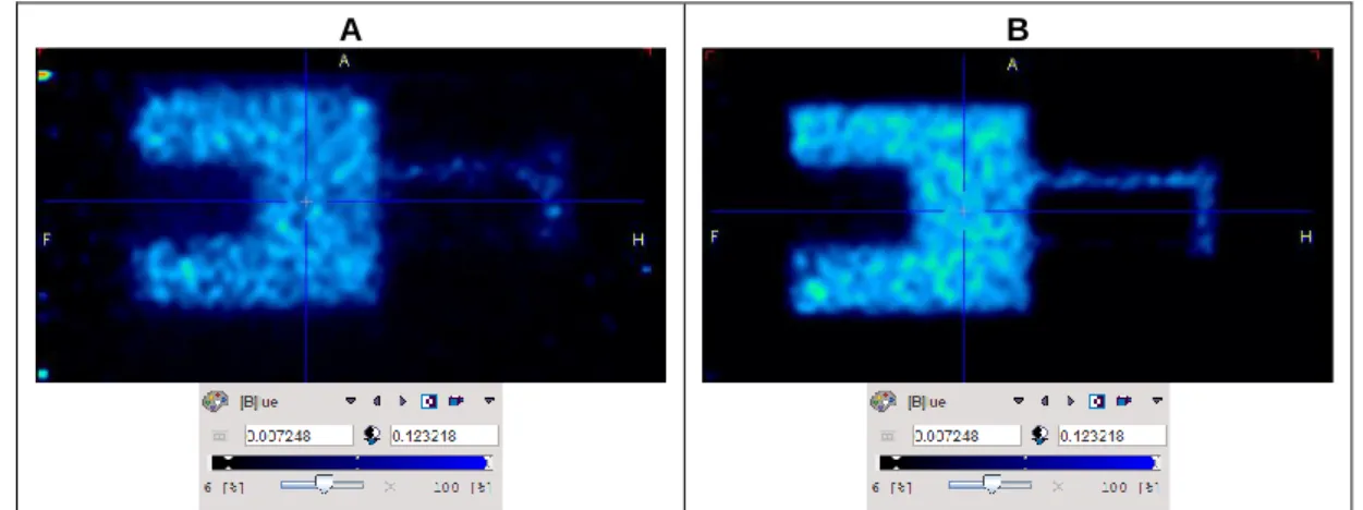 Figure 2: PET image (sagittal plane) of the Image Quality phantom using  11 C (A) e  18 F (B)