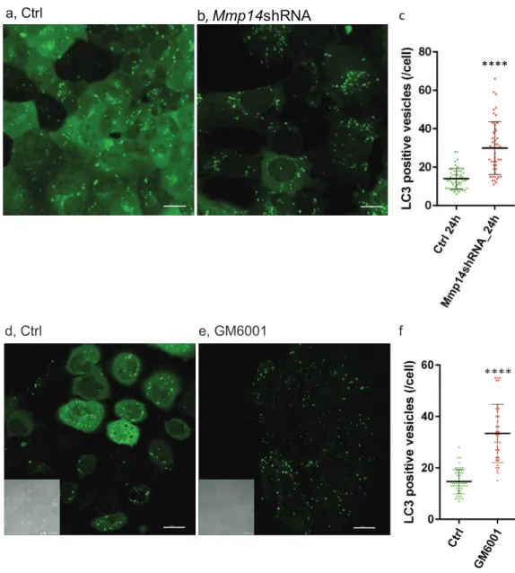 Figure 6 Silencing Mmp14 in mammary epithelial cells formed more autophagosomes. Changes in distribution of GFP tagged LC3 (GFP-LC3) in mouse mammary epithelial cells at 24 h post nutrient starvation are shown