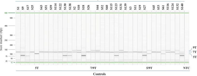 Figure 3 Example of Poly-T analysis using multiplex AS-PCR. Results of AS-PCR were listed in Table 1 and Table S1 and confirmed by published data or Sanger sequencing