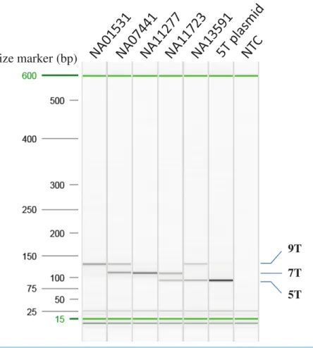 Figure 2 Optimization of AS-PCR for poly-T analysis. All the samples used for optimization of the multiplex AS-PCR have known poly-T allele information: NA01531 (9/9T), NA07441 (7/9T), NA11277 (7/7T), NA11723 (5/7T) and NA13591 (5/9T)