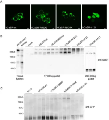 Figure 1. Expression and localization of Calcium Sensing Receptors (CaSR) in HEK-293 cells