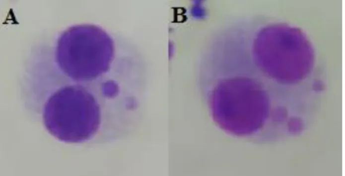 Figura 1: Células binucleadas com dois micronúcleos (A) e com três micronúcleo (B)  