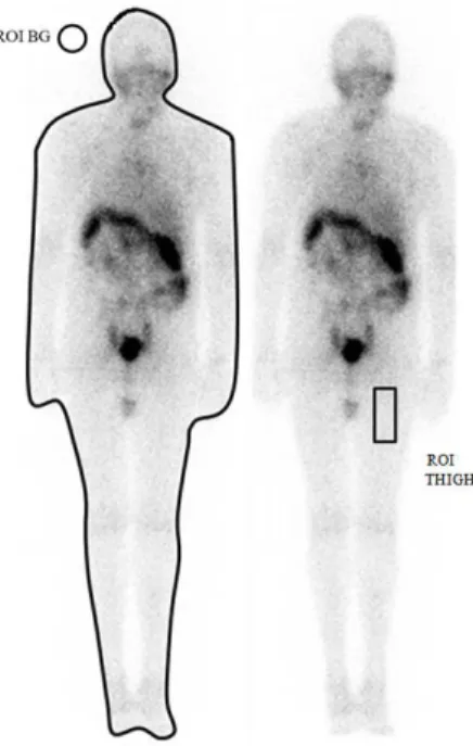 Figure 1: Flat images, exemplifying the design of the ROIs. On the left, whole body ROI (WB); on  the right, thigh ROI