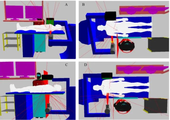 Figura 1. Vista das direções de feixe oblíqua anterior (A) direita (RAO65) e (B) esquerda  (LAO65); (C) pôstero-anterior (PA) e (D) lateral esquerda (LAO90)