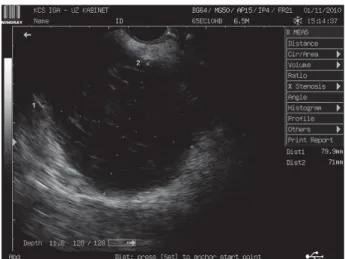 Fig. 1 – Transvaginal ultrasound image showing a hypoechogenic mass (paravesical haemathoma).