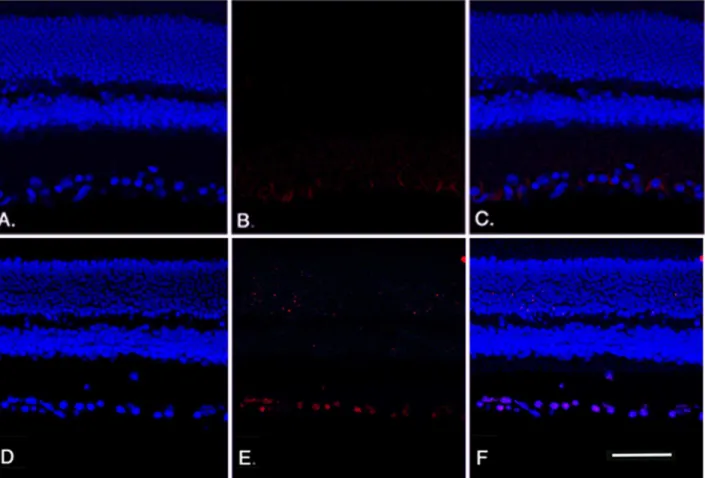 Figure 4. Apoptosis staining analyses. TUNEL results for wildtype mice (A-C) and b2-adrenergic receptor KO mice (D-F) showing DAPI staining (A, D) and TUNEL labeling (B, E) with overlay provided in panels C, F