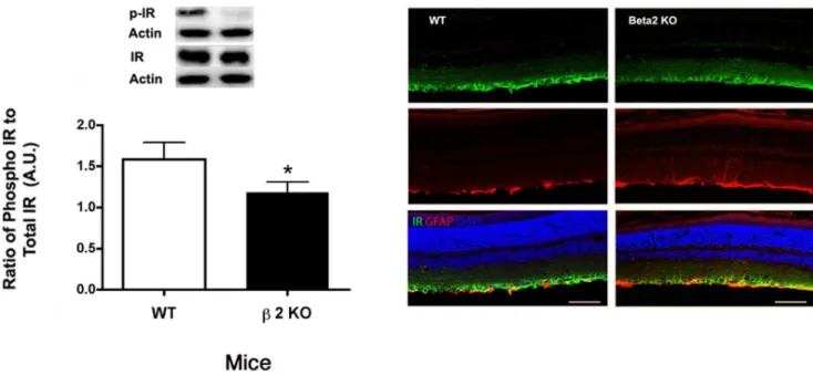 Figure 8. Insulin Receptor Levels and localization. Left Panel: Western blot results for phosphorylated insulin receptor (Tyr 1150/1151) in b2- b2-adrenergic receptor knockout mice vs