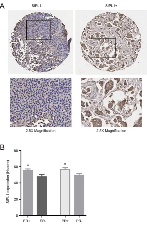 Fig 5. SIPL1 protein expression is associated with ER+ and PR+ tumours. (A) A TMA was examined for SIPL1 protein expression using IHC