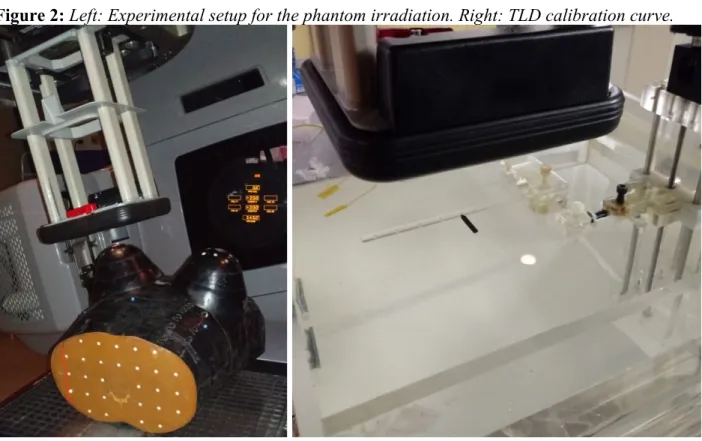 Figure 2: Left: Experimental setup for the phantom irradiation. Right: TLD calibration curve