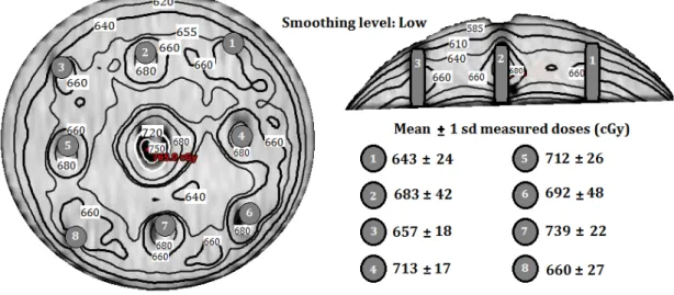 Figure 4: Isodose distribution for the 1 st  layer, using the low level 3D Gaussian smoothing