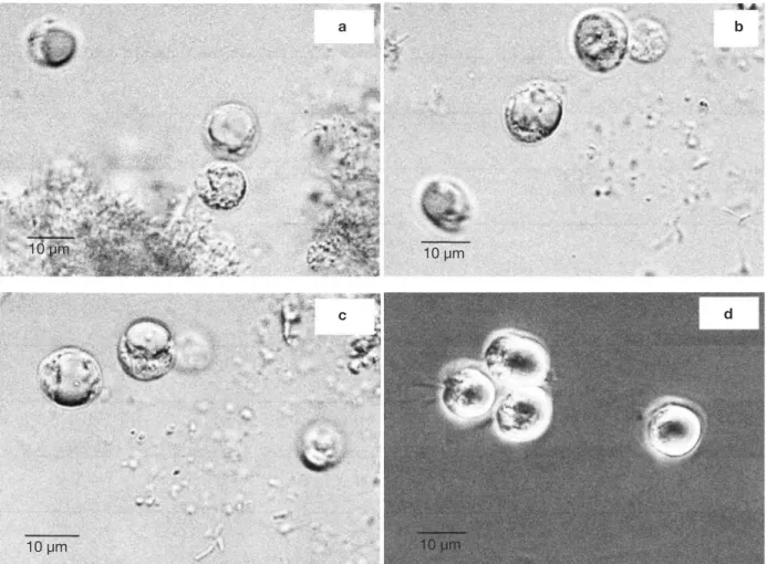 Figure 1. a, b, c, d. Various photographs of a same sample of protist isolated from the gut of Reticulitermes santonensis  growing in the rice medium after addition of ciproloxacin (pictures taken using an electron microscope, images obtained with  an Axio