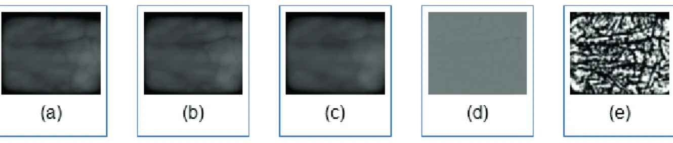 Fig. 2. Amostra das veias da palma antes e depois dos estágios de pré-processamento (a) imagem original,  (b) ﬁ ltro gaussiano, (c) ﬁ ltro de mediana, (d) subtração de b por c e ajuste de contraste, (e) Binarização.