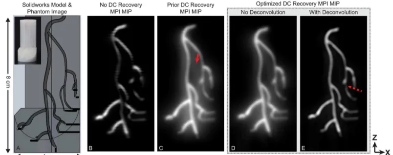 Fig 4. Experimental MPI data from a coronary artery phantom. Images were reconstructed with the proposed reconstruction formulation and contrasted to the previous 1 D DC recovery as well as no DC recovery