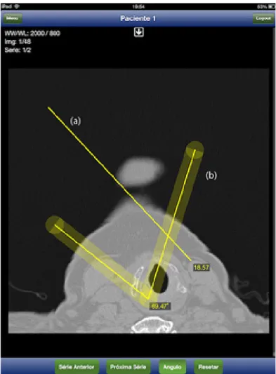 Figure 7 - Left: Image visualization and analysis screen showing  length and angle measurements and tooltips explaining the  func-tionality of each screen tool