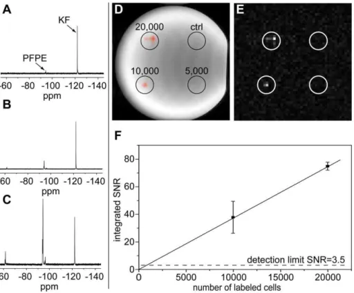 Figure 1. Optimization of labeling and in vitro detection limits. A–C: 19 F MRS of NSCs incubated with 15 mL (A), 50 mL (B), and 100 mL (C) PFPE emulsion per mL medium together with a KF solution as an internal standard, KF frequency set to 2120.9 ppm, mai