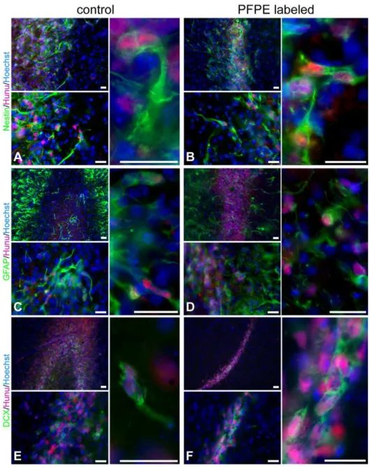 Figure 4. Effect of the 19 F marker on cell phenotypes in vivo . Photomicrographs of non-labeled control (A, C, E) and PFPE labeled NSCs (B, D, F) on tissue sections from transplanted animals
