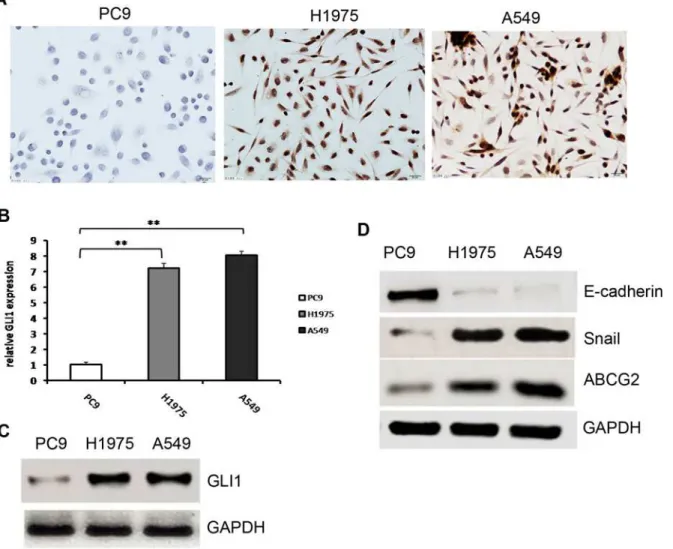 Fig 1. Hh pathway activity in EGFR-TKI-sensitive and -resistant cells. (A). Differences in GLI1 expression in EGFR-TKI-sensitive and -resistant NSCLC cells determined with immunocytochemistry
