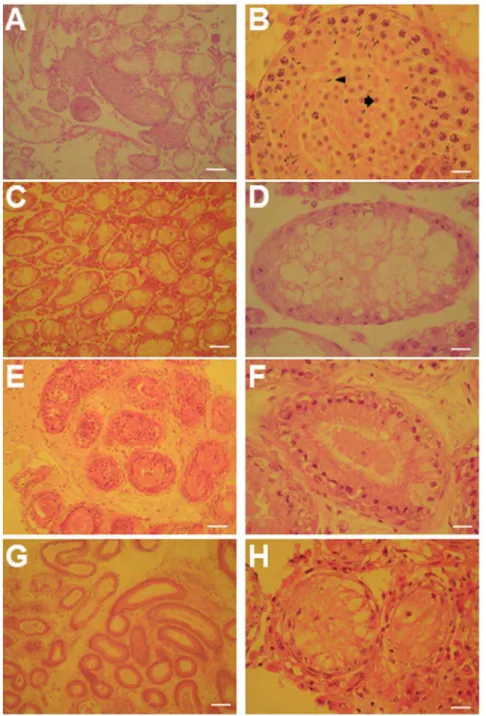 Figure 3. Histological sections of transplanted and non-transplanted GSCs into the testis