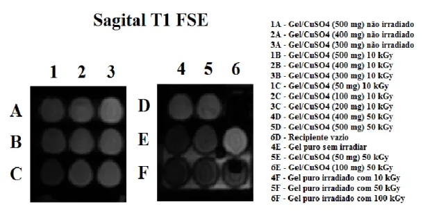 Figura 1: Imagens obtidas das amostras em ponderação T1 sequência FSE e a codificação  das amostras conforme composição e dose de radiação recebida