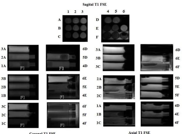 Figura 2:    Imagem das amostras obtidas em ponderação T1 sequência FSE codificadas nos cortes  sagital, coronal e axial.