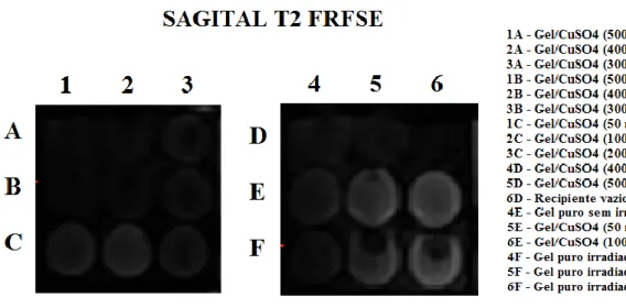 Figura 4: Imagem das amostras obtidas em ponderação T2 sequência FRFSE e a codificação das  amostras conforme composição e dose de radiação recebida