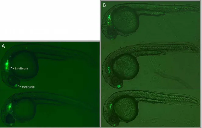 Figure 3. Comparison of CCE-lmo1 Stable and Transient Transgenic Expression. (A) Stable transgenic F1 embryos from two independently generated lines displaying strong forebrain and hindbrain expression