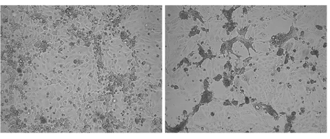 Fig 1. Cytopathic effects of HMPV strains and recombinant HMPV viruses. (a) microscopic images of cytopathic effects induced by HMPV infection of LLC-MK2 monolayers