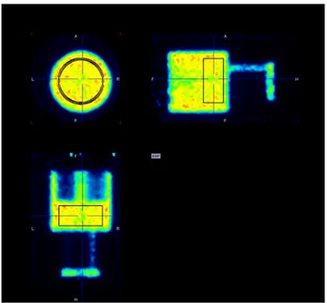 Figure 3: Uniformity test: cylindrical VOI (22.5 mm diameter and 10 mm height) is positioned in  the center of the main chamber