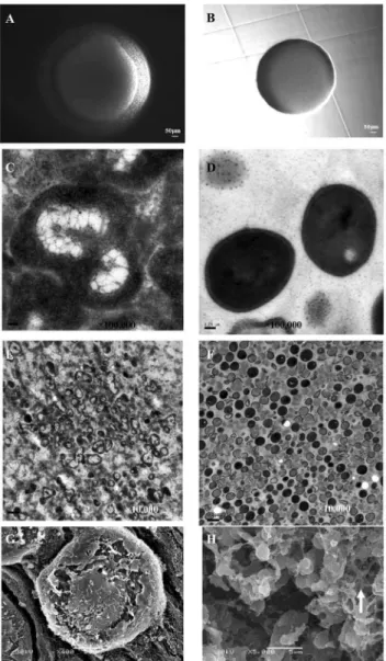 Figure 1. Comparison of L-form and classical form S. aureus morphologies. (A). S. aureus Newman L-form colony on L-form induction media (LIM) exhibiting typical ‘‘fried egg’’ morphology