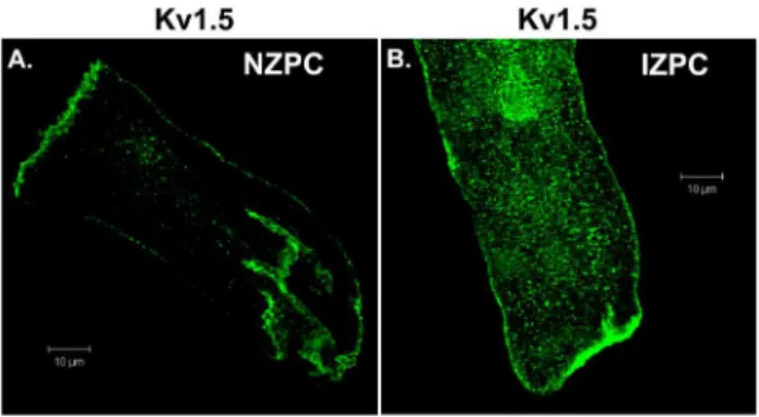 Figure 1. Immunolocalization of Kv1.5 in a single NZPC (A) and IZPC (B). Horizontal scale = 10 mm.