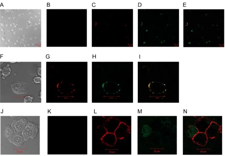 Figure 3. Coimmunoprecipitation of PCNA with HLA I. DB and DU145 cell lysates were first cleared of endogenous and cancerous immunoglobulins, as detailed in material and methods prior to precipitation experiments