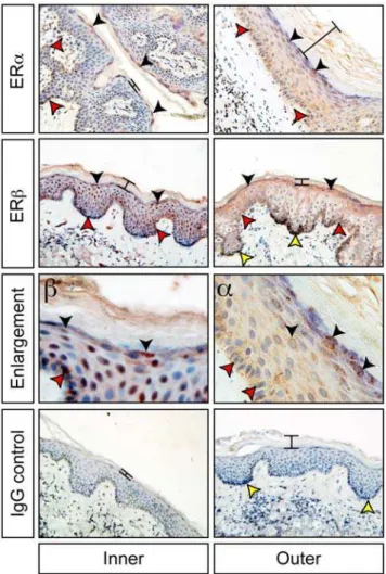 Figure 1. ERa (a) and ERb (b) protein distribution (brown staining) in the inner and outer aspects of the foreskin